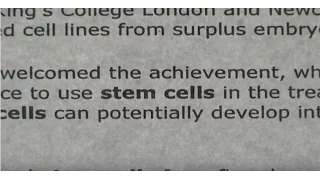 A Stem Cell Story