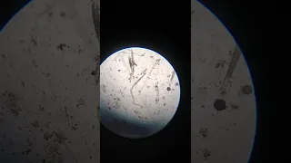 nematode under microscope