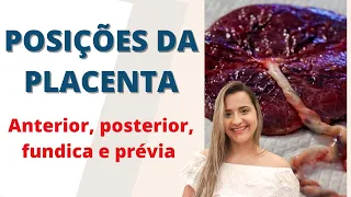 POSIÇÕES DA PLACENTA - Anterior, posterior, fundica e prévia | Psicóloga Daniella- Manual dos pais