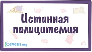 Истинная полицитемия — причины, симптомы, патогенез, диагностика, лечение