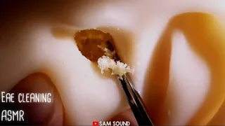 ASMR  Dig up earwax, Ear cleaning [fake earwax, Visual tingleear ] No talking