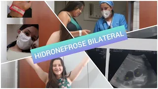 Como descobri a HIDRONEFROSE BILATERAL FETAL |  PARTE 1