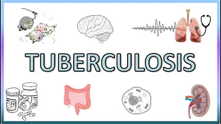 Tuberculosis - Types, Pathogenesis, Signs and Symptoms, Diagnosis, Treatment and Prevention