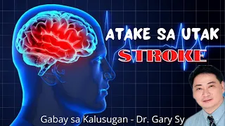 Stroke (Brain Attack) - Dr. Gary Sy