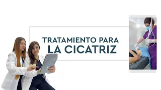 ¿Cómo tratar la cicatriz después una cirugía plástica?🧑‍⚕️