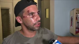 Gay couple believes Miami Beach attack was hate crime