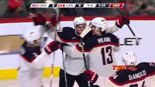 Canada vs USA  Day 6 (31/12/2014)  IIHF World Junior Champs 2015 Highlights HD