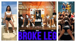 Broke Leg!!! | V70 |Life as a DANCER in LOS ANGELES |