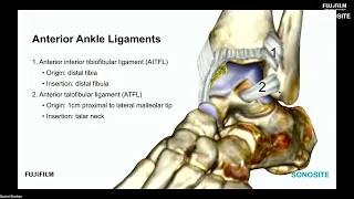 Webinar: Diagnostic Ankle Ultrasound: Anterior