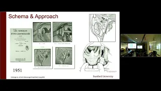 Precision Head & Neck Surgery: Robotics and Beyond