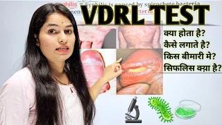 VDRL Test | VDRL Test in hindi | Venereal disease research laboratory | Microbiology