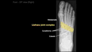 Anatomy of Foot X-rays