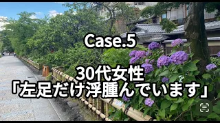 【症例】Case.5 左足だけ浮腫んでいるんです…(30代女性)～私が出会った患者さん～