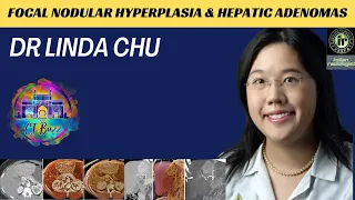 DR LINDA CHU | FOCAL NODULAR HYPERPLASIA & HEPATIC ADENOMAS