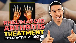 Integrative Medicine Guideline Treatments to Rheumatoid Arthritis | Dr. Micah Yu