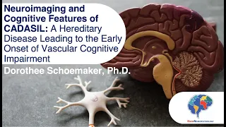 Neuroimaging and Cognitive Features of CADASIL