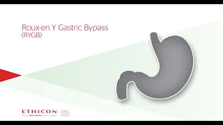 Roux-en Y Gastric Bypass (RYGB)