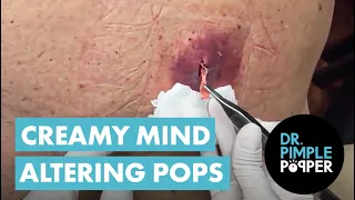 Chaotic Pops That Altered My Brain Chemistry