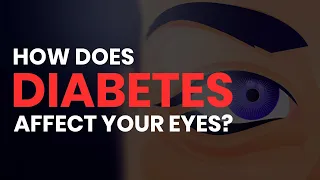 How Diabetes Affects Your Eyes (Retinopathy, Glaucoma, Cataracts, Macular Edema)