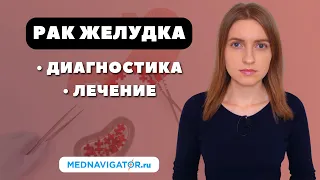 Как ВЫЛЕЧИТЬ РАК ЖЕЛУДКА? Диагностика и лечение ОПУХОЛЕЙ ЖЕЛУДКА #меднавигатор