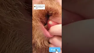 Pimple Popping & Blackheads 4K