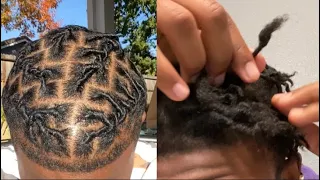 My Starter Locs Are BUDDING in 2 weeks?!? 😱 | Dreadloc Journey