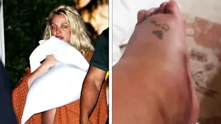 Britney Spears Shows Off Bruised Foot After Hotel Incident