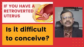 Retroverted uterus - is it difficult to conceive