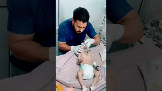 #INTUBATION FOR BABY SEVER DEHYDRATION &unconscious admitted for ankur Maitrika hospital  (NiCU)
