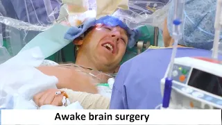 Awake brain surgery - Brain tumour