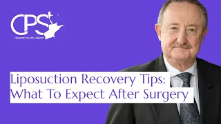 Liposuction Recovery Tips: What To Expect After Surgery