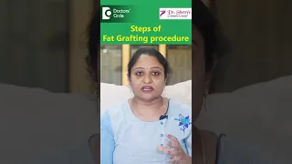 Steps of FAT GRAFTING Procedure explained in 1 minute - Dr. Ramya Deepthi|Know Your Doctor #shorts