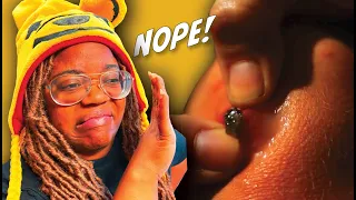 Snail Lives In Young Boy's Knee | Monster's Inside Me | AyChristene Reacts