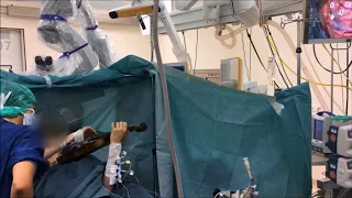 Playing violin in awake brain tumor surgery