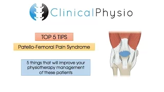 Top 5 Tips: Patello-Femoral Pain Syndrome | Clinical Physio