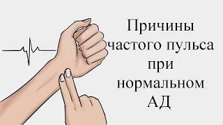 Причины частого пульса при нормальном АД