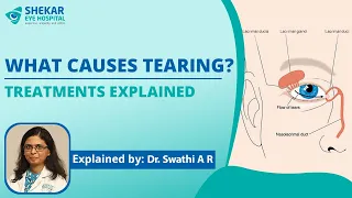 What causes tearing/watery eyes? Treatments Explained