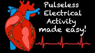 EMS Cardiology || Tachy Tuesday: Pulseless Electrical Activity (PEA) in EMS