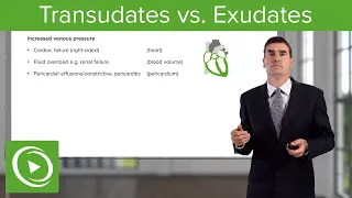 Transudates vs. Exudates – Pleural Disease | Lecturio