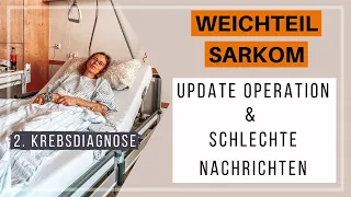 Weichteilsarkom | Operation & Schlechte Nachrichten | 2. Krebsdiagnose Update