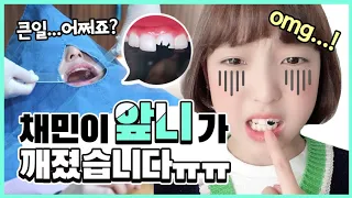 실제상황 채민이 앞니 깨졌습니다....병원에 급히 간 채민이 어떤 치료를 받았을까요?...｜클레버TV