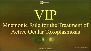 Ocular Toxoplasmosis. VIP, Mnemonic Rule for the Treatment of Active Ocular Toxoplasmosis.