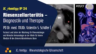 JC_rhmtlgy 24: "Riesenzellarteriitis – Diagnostik und Therapie"