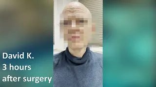 David K. before and after augmentation of vocal folds