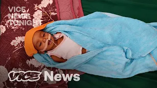 Children in Yemen Are So Hungry They’re Eating Their Own Hands