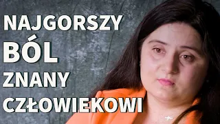 To schorzenie neurologiczne nazywają "chorobą samobójców". "Trzeba mieć nadzieję" | SKRAWKI