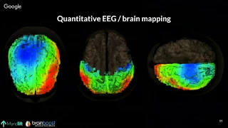 Fundamentals of Neurofeedback [Webinar]