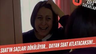 Suat'ın Saçları Dökülüyor! Dayan Suat Atlatacaksın! 329. Bölüm