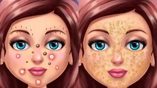 Skin Care Animation - Facial Treatment, Acne removal