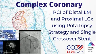 PCI of Distal LM and Proximal LCx using RotaTripsy Strategy and Single Crossover Stent